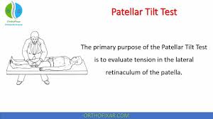 Image result for Patellar Tilt Test