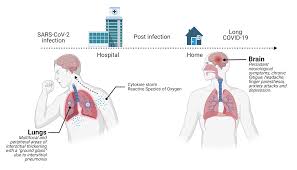 These symptoms may be due to four different syndromes Brain Sciences Free Full Text Long Term Brain Disorders In Post Covid 19 Neurological Syndrome Pcns Patient