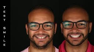 Capítulo 3: Como diferenciar planejamento de plano de tratamento?