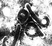 Marburg virus disease was initially detected in 1967 after simultaneous outbreaks in marburg and frankfurt in germany; Todesserie Marburg Virus Bricht In Angola Aus Der Spiegel