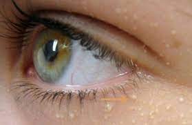 recettes maison pour traiter les petites boules de graisse sous les yeux boule de graisse visage sous les yeux produits de soins de la peau