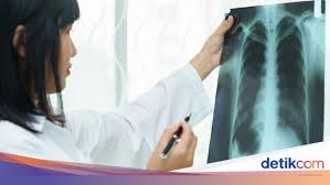 Selepas kita menghirup udara yang bergerak dari hidung/mulut dan melalui saluran trachea, oksigen yang terkandung dalam udara tadi akan hadir ke dalam alveoli. Pneumonia Vs Tbc Sama Nggak Sih Yuk Tanya Dokter Paru