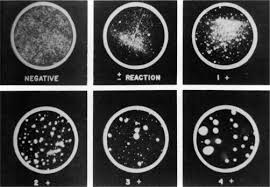 Image result for Treponema