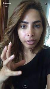 We did not find results for: Ø¹Ø¨Ø¯Ø§Ù„Ù„Ù‡ Na Twitterze ÙÙˆØ² Ø§Ù„ÙÙ‡Ø¯ Ù„ÙŠ Ø³Ù†ØªÙŠÙ† Ø§ØªØ§Ø¨Ø¹Ù‡Ø§ ÙˆØ§Ø´ÙˆÙÙ‡Ø§ ÙˆØ®Ø§Ù‚ Ù…Ø¹Ù‡Ø§ ÙˆØ§Ù„ÙŠÙˆÙ… Ø§ÙˆÙ„ Ù…Ø±Ø§ Ø§Ø´ÙˆÙÙ‡Ø§ Ø¨Ø¯ÙˆÙ† Ù…ÙƒÙŠØ§Ø¬ Ø§ÙƒØªØ´ÙØª Ø§Ù†ÙŠ Ø§ØªØ§Ø¨Ø¹ ÙÙ‡Ø¯ Ù…Ùˆ ÙÙˆØ² Ø§Ù„ÙÙ‡Ø¯