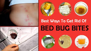Bedbugguide.com has been visited by 10k+ users in the past month How To Treat Bed Bug Bites With Home Remedy Bed Bug Bites Rid Of Bed Bugs Bug Bites Remedies