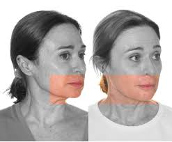 Dr. Joan Ramon Garces Gatnau