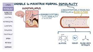 Diabetes Insipidus And Siadh Pathology Review Osmosis