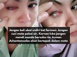 Punca tekanan darah rendah atau hipotensi antaranya dehidrasi, masalah kesihatan jantung, kekurangan vitamin b12 serta pendarahan. Ubat Sakit Mata Merah Di Farmasi Berubat 1