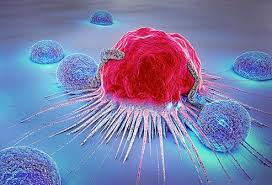 Signs of anemia are tiredness, weakness, and shortness of breath. How Do You Detect Bone Cancer