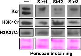 $15 (excl gst) | find your lecky's store; Identification Of Erasers For Lysine Crotonylated Histone Marks Using A Chemical Proteomics Approach Elife