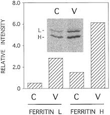 When you buy through our links, we may get a commission. Induction Of Ferritin Synthesis In Cells Infected With Mengo Virus Journal Of Biological Chemistry