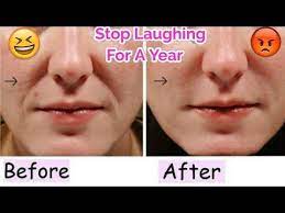 Other secondary factors that can lead to laugh lines include loss of collagen and elastin (the building blocks of the skin), as well as weight fluctuations. Get Rid Of Laugh Lines In 5 Minutes Laugh Lines Get Rid Of Laugh Lines Face Wrinkles
