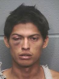 Firefighter loses legs after getting hit by stolen car