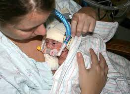 Kangaroo Care In The Nicu Kangaroo Care Nicu Nicu Neonatal Intensive Care Unit