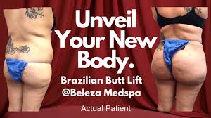 With growing numbers opting for cosmetic surgery through high street clinics, what happens when things go wrong? Brazilian Butt Lift Austin Brazilian Butt Lift Cost Beleza Medspa Austin Tx