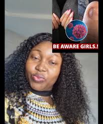 Dangers of wearing acrylic nails to health