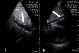 Most of our facilities are open 365 days a year, and offer patients access to advanced, comprehensive care from 9 a.m. Pocket Sized Focused Cardiac Ultrasound Strengths And Limitations Sciencedirect