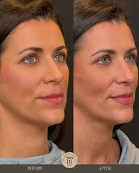 Community Highlights: Meet Sydney Erickson of The Renewal Institute and The  Emerald at La Colombe d'or