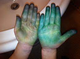 How To Get Easter Egg Dye Off Your Hands The Mama Bird Diaries
