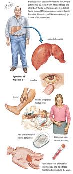 You can't spread hepatitis b through casual contact, so don't cut yourself off from people who can offer support. Chronic Hepatitis B Spectrum Health