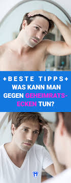 ab einem gewissen alter bekommen viele manner unschone geheimratsecken an den den seiten ihres haaran haarausfall manner geheimratsecken frisur geheimratsecken