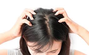 These head lice pictures can help you to identify when your child has live lice on their head. Head Lice How To Get Rid Of Them With Simple Steps Skinkraft