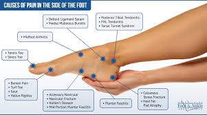 Image result for Foot Pain