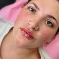 We loved how these lips turned out 😍😍😍 Want to start your lip filler  journey? Contact us via WhatsApp to book your appointments. +27 (082) 385  3320 **patient approved media release**