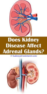 Pin On Polycystic Kidney Disease