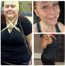 How much weight do you have to lose? My wife has helped people that don't  need to lose any, but needed to heal their gut, to people that need to lose  20