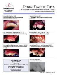 Image result for Tooth Fracture