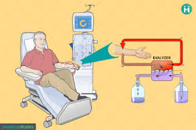 No custom animation possible for skyrim? Dialysis Types Uses Procedure