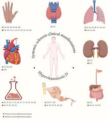 Image result for Systemic Sclerosis