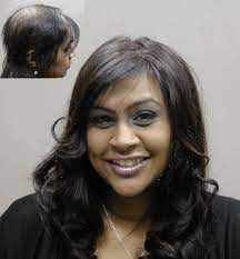 Female Hair Replacement And Hair Loss Solutions For Women Surehair International
