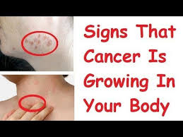 Pin On Health