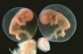 Once you realize you are in the 19th week of pregnancy with twins in your womb, it tends to be quite an important stage since you are coming close to completing 5 months of pregnancy. Placental Pathology Human Embryo Medical Illustration Baby In Womb