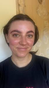 BIO REPEEL x DERMAPLANING , One of my fav treatments ever! Dermaplaning  removes all of the dead surface debris from the skin as well as vellus hair  so that the peel can penetrate the skin most ...