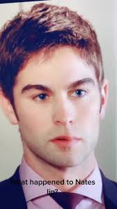 What Happened to Nate World 1 1 9 Bottom Lip