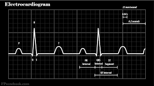 Image result for Electrocardiogram Validity