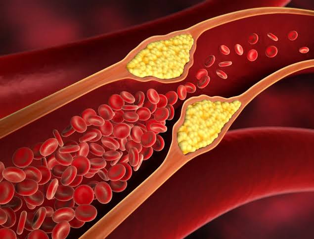 Phát triển thuốc mới giảm cholesterol máu