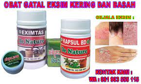 Di sebabkan pertumbuhan jamur tersebut yang berasal dari kurangnya menjaga kesebersihan tubuh dan kontak secara langsung dengan penderita atau memakai barang miliki pribadi penderita seperti penggunaan handuk. 24 Salep Obat Gatal Eksim Basah Paling Manjur Di Apotik
