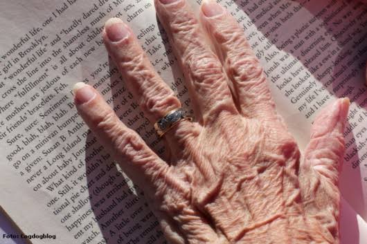 Unhas idosas – ABRAFHA