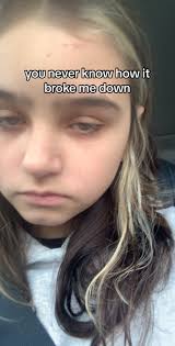 Stepping Stones Monash Mental Health Unit