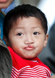 A second chance to smile