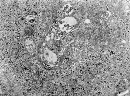 Arbovirus Wikipedia