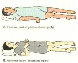 Gang Starr S Guru In Coma Celebrity Diagnosis Intracranial Pressure Nclex Nursing School