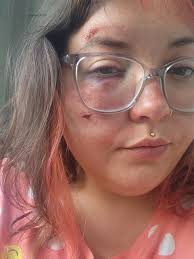 New building in my neighborhood. I can see the police report “It appears  the victim slipped