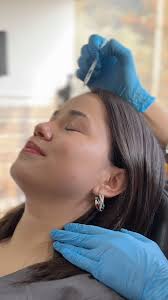 Resultado inmediato de Ellansé : un bioestimulador a base de  policaprolactona. El objetivo de los bioestimuladores es inducir la  producción de nuevo colágeno y elastina, y recuerden que se demoran 3 meses