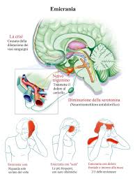 Mal Di Testa Continuo O Frequente Nausea Cause Rimedi Naturali