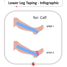 Image result for Taping for Soleus and Achilles